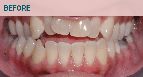 Before Image Before image