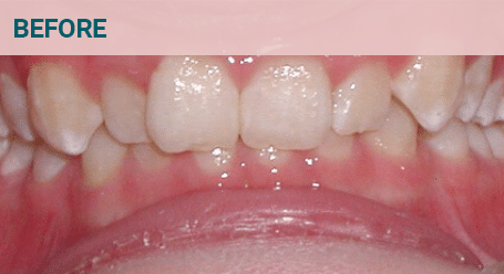 Before Image Before image
