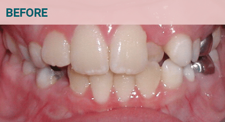 Before Image Before image