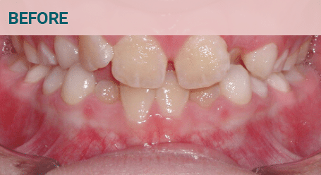 Before Image Before image