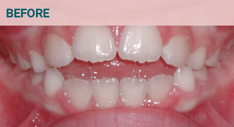 Before Image Before image
