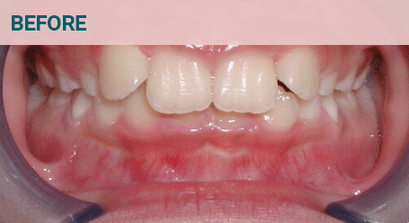 Before Image Before image