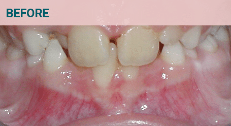 Before Image Before image