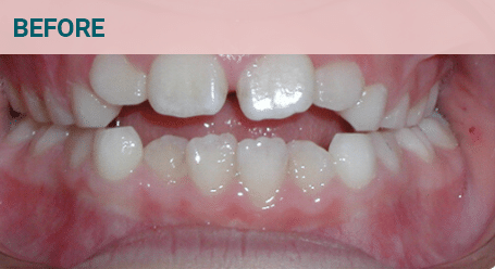 Before Image Before image