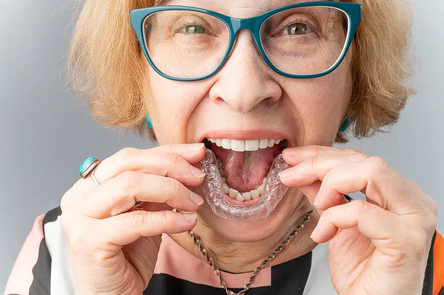 Am I Too Old For Braces? 2 An older woman insereting an invisalign clear aligner to show that you are not too old for braces
