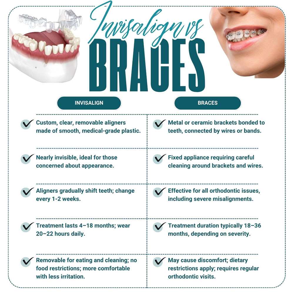 Invisalign vs braces