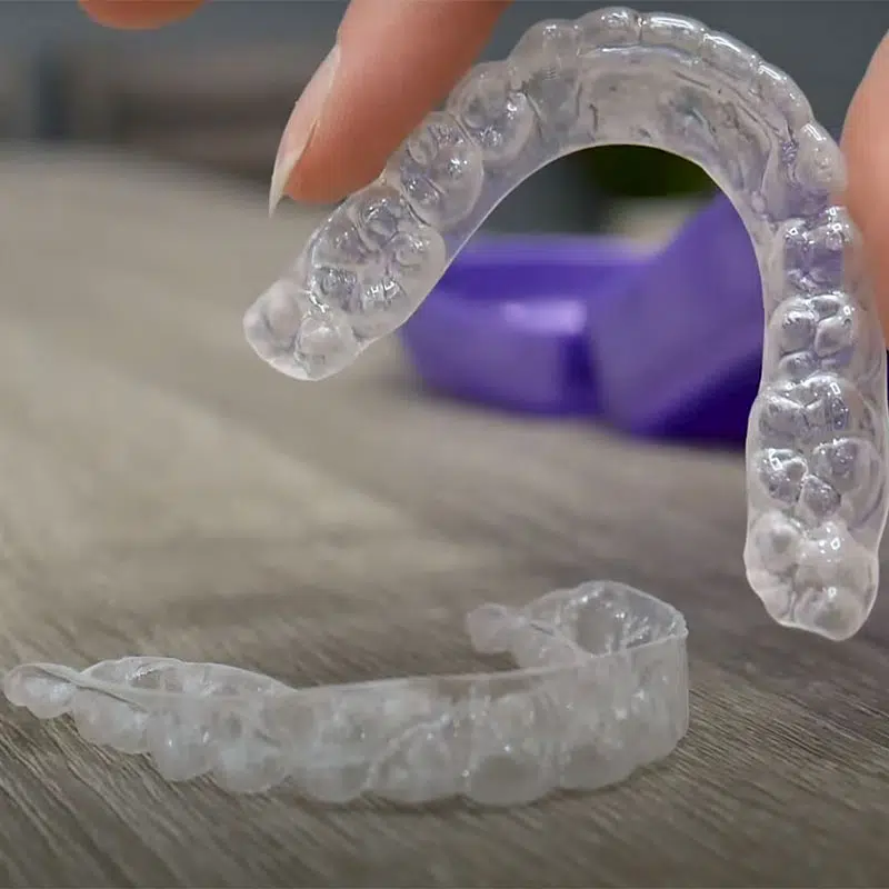 Orthodontic Retainer Specialists 3 Removable retainers