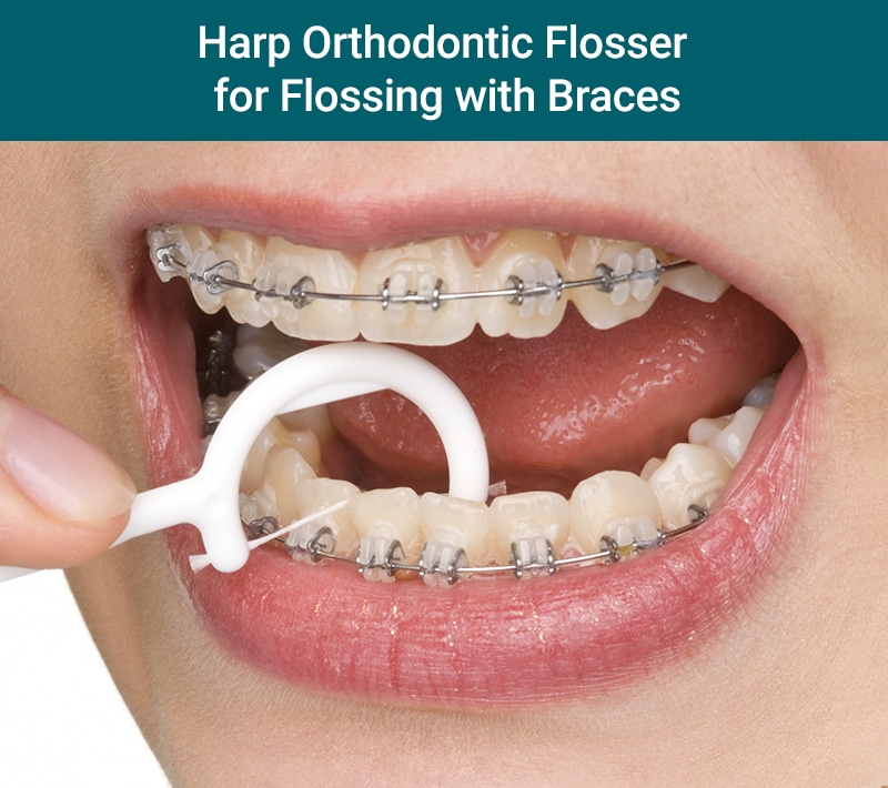 How to Floss With Braces Gibbs Orthodontic Associates