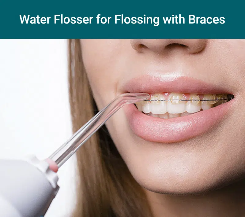 Water flosser for flossing with braces