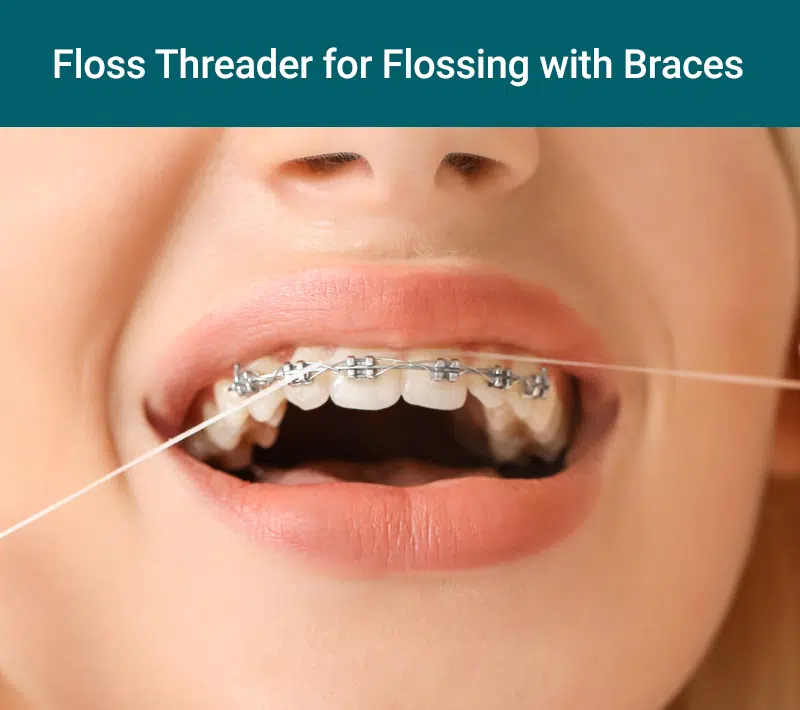 Floss threader for flossing with braces