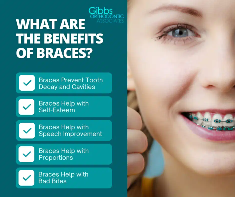 What are the benefits of braces