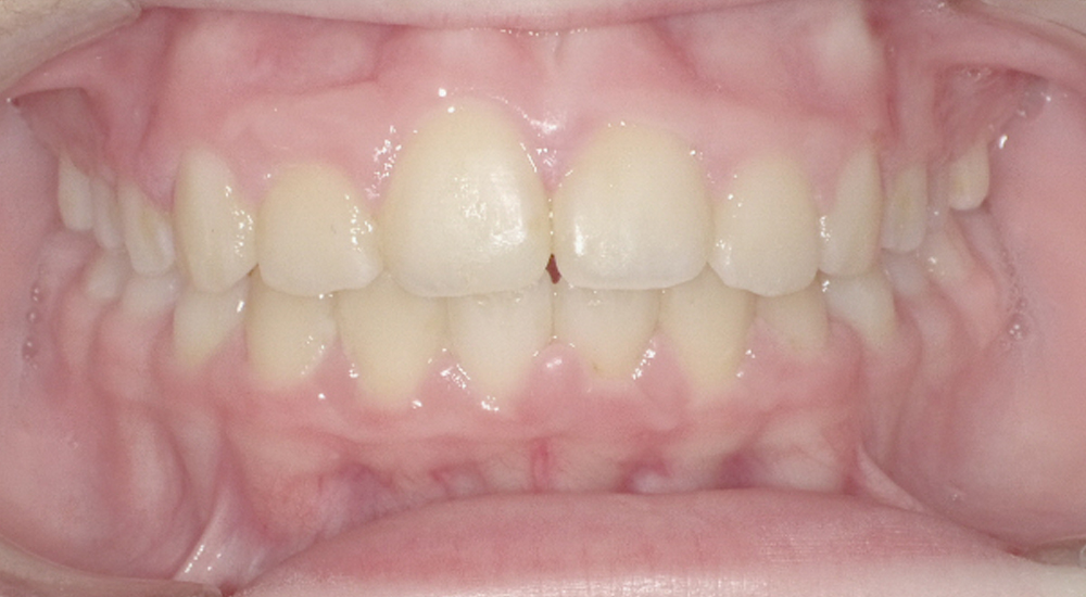 Before And After 4 After image
