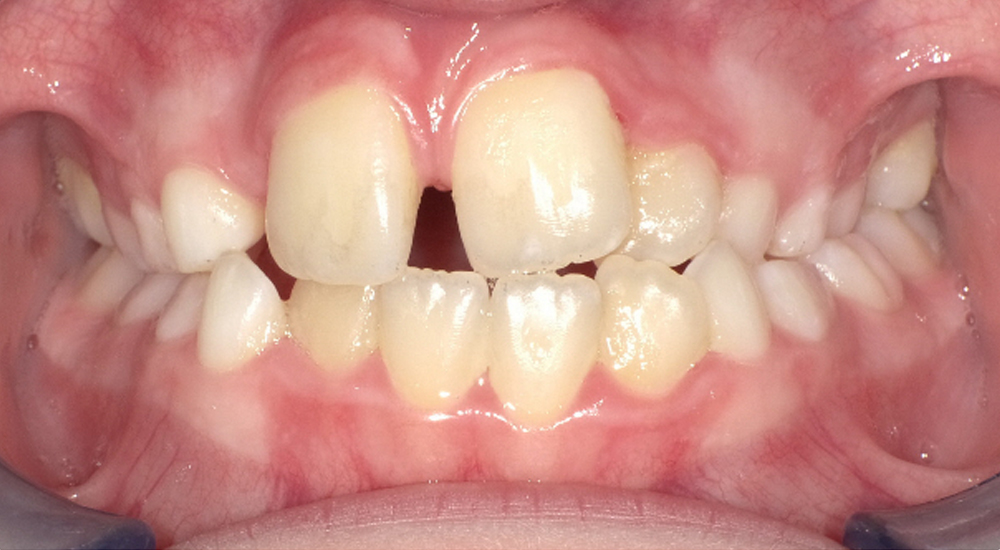Before And After 11 Before image