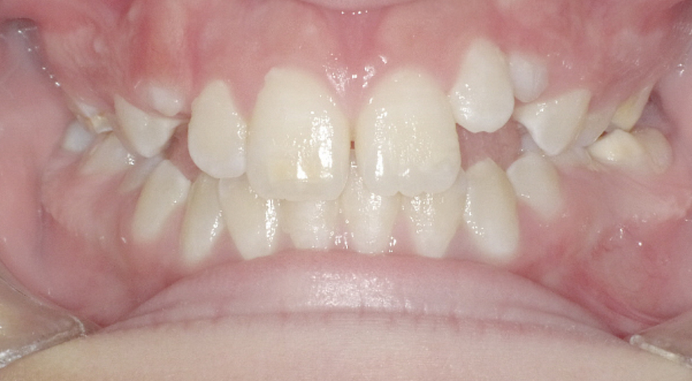 Before And After 15 Before image