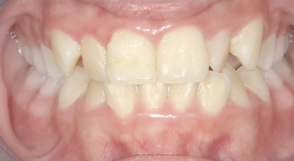 Before And After 19 Before image