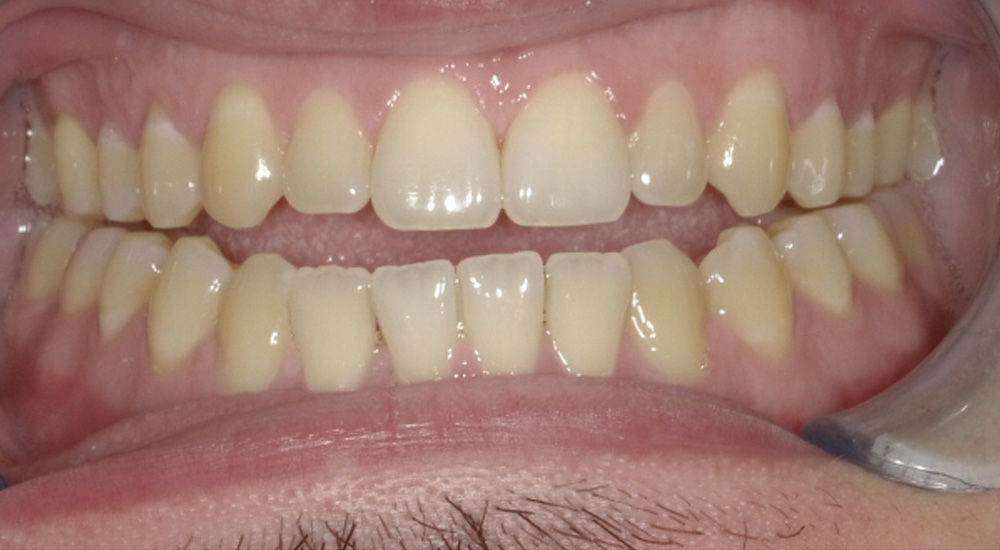 Before And After 21 Before image