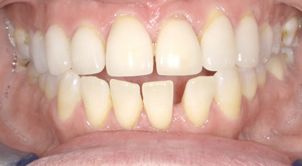Before And After 23 Before image