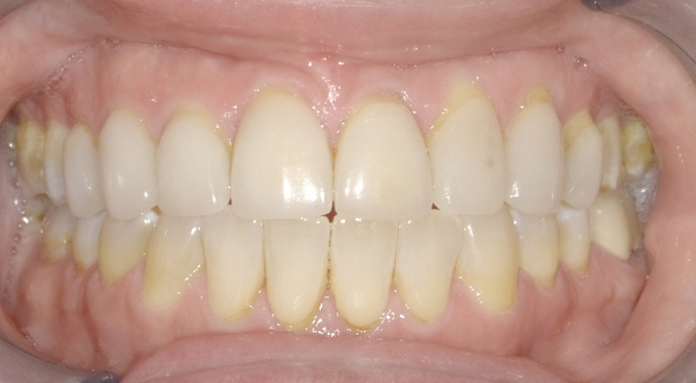 Before And After 24 After image
