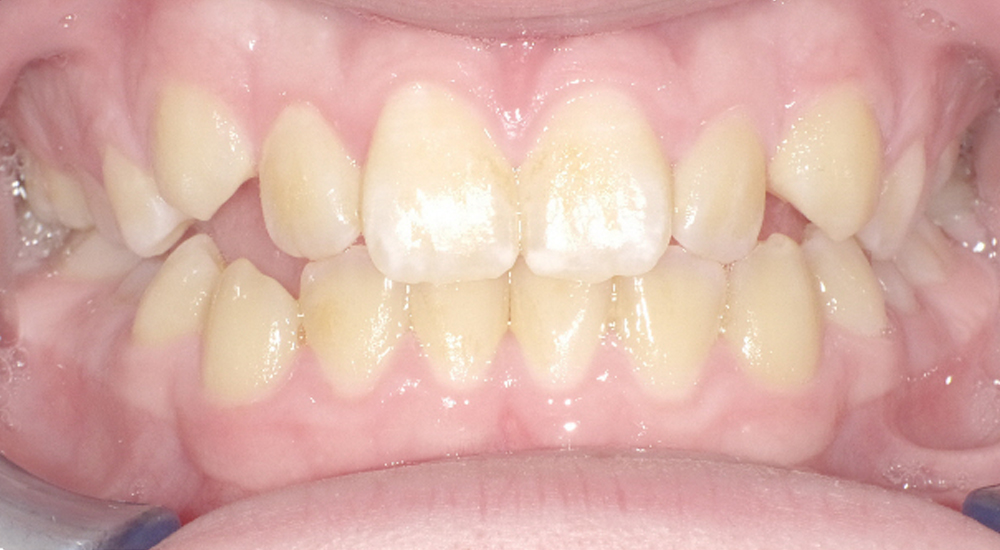 Before And After 25 Before image