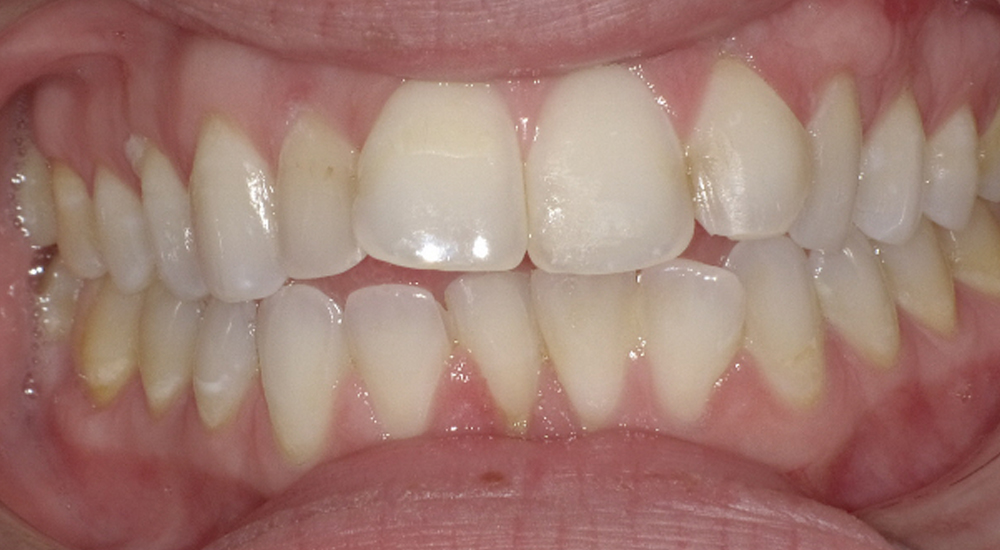 Before And After 27 Before image