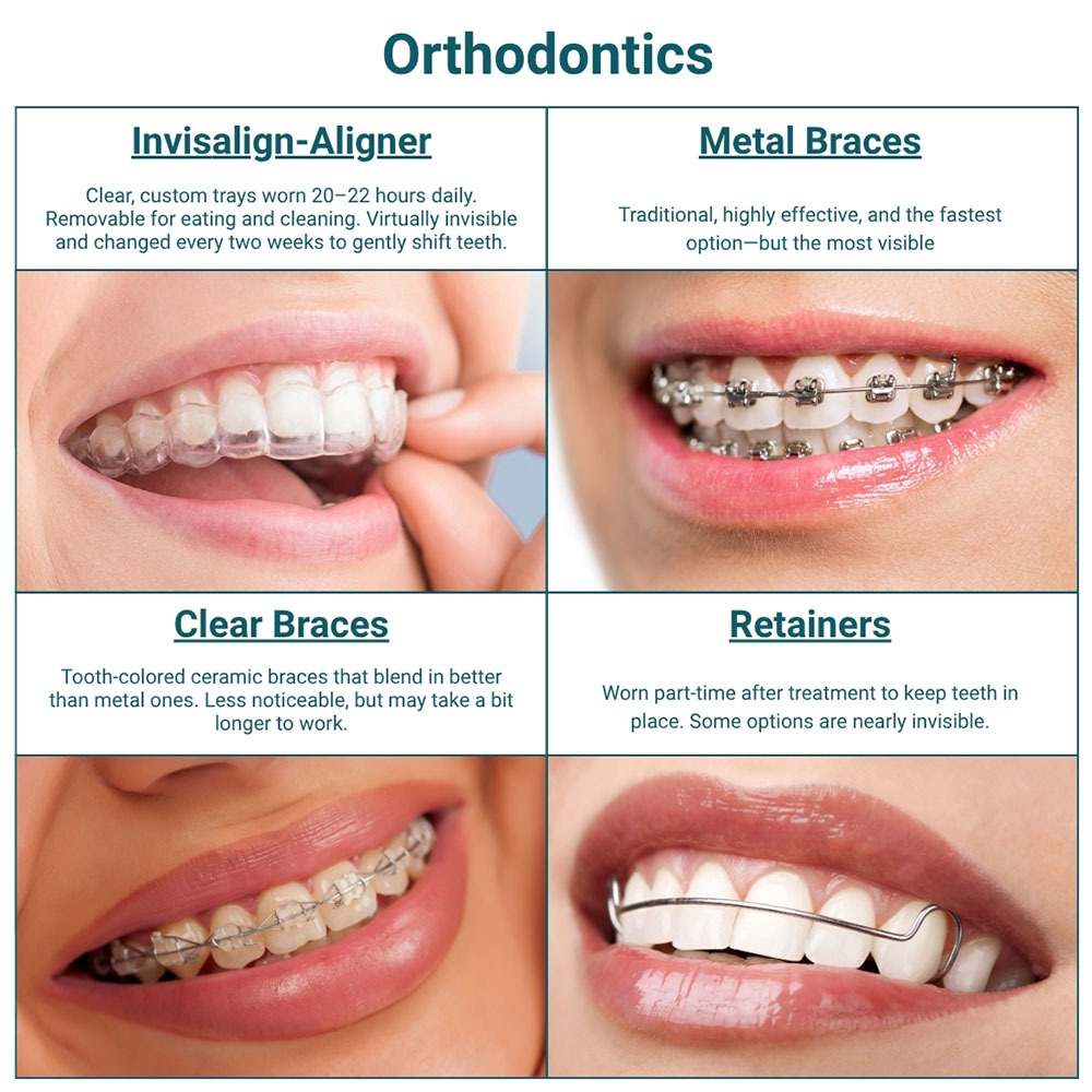 Orthodontic treatments in upper east side